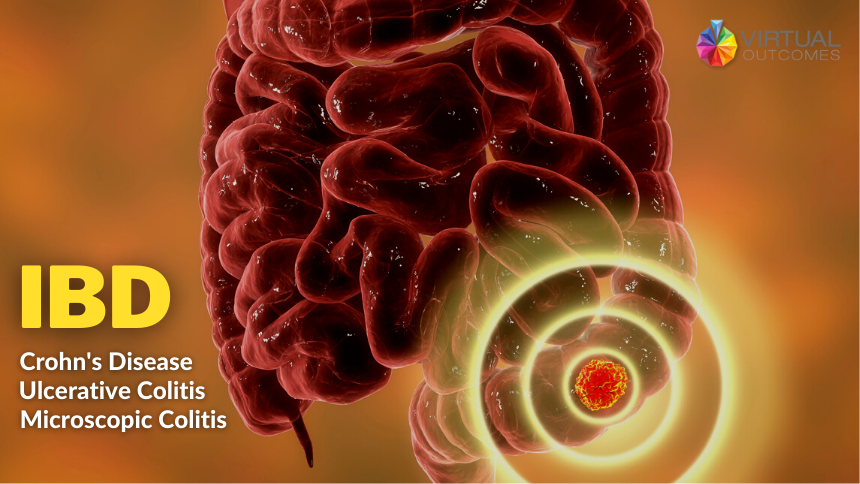 IBD symptoms, causes and treatment